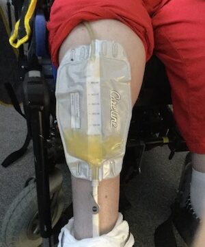 cather bag attached to leg