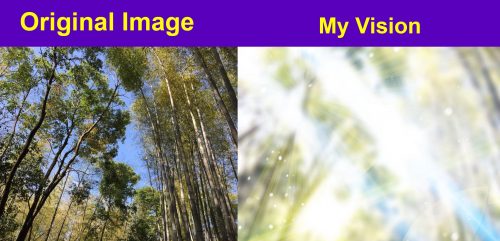 Left image: Original image - image looking up at trees on sunny day. Right image: My vision - Bright lights blurring out the trees